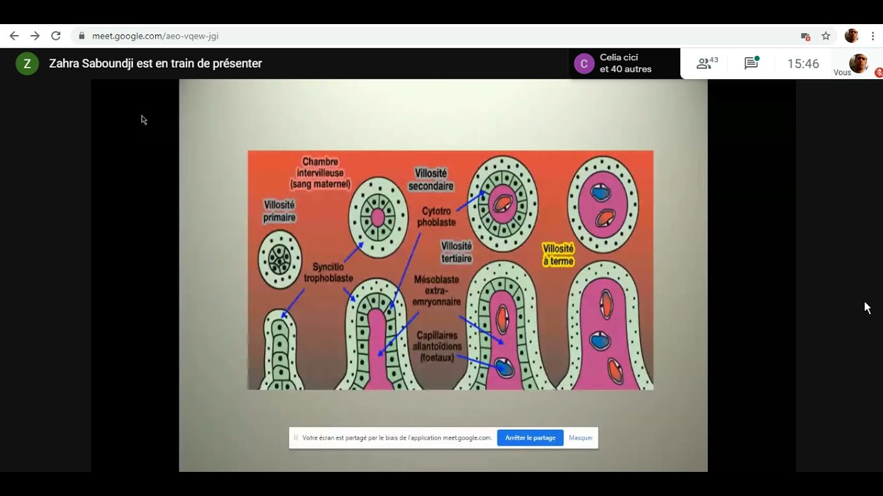 #Gynéco | 12. La maladie trophoblastique gestationnelle (MTG) -Tizi- (Dr Saboundji)