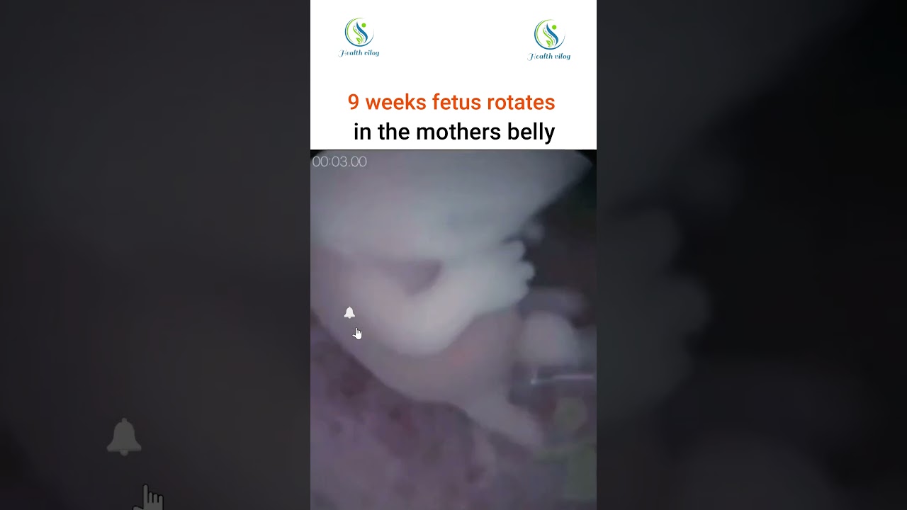 9 weeks fetus rotates in the mothers belly 