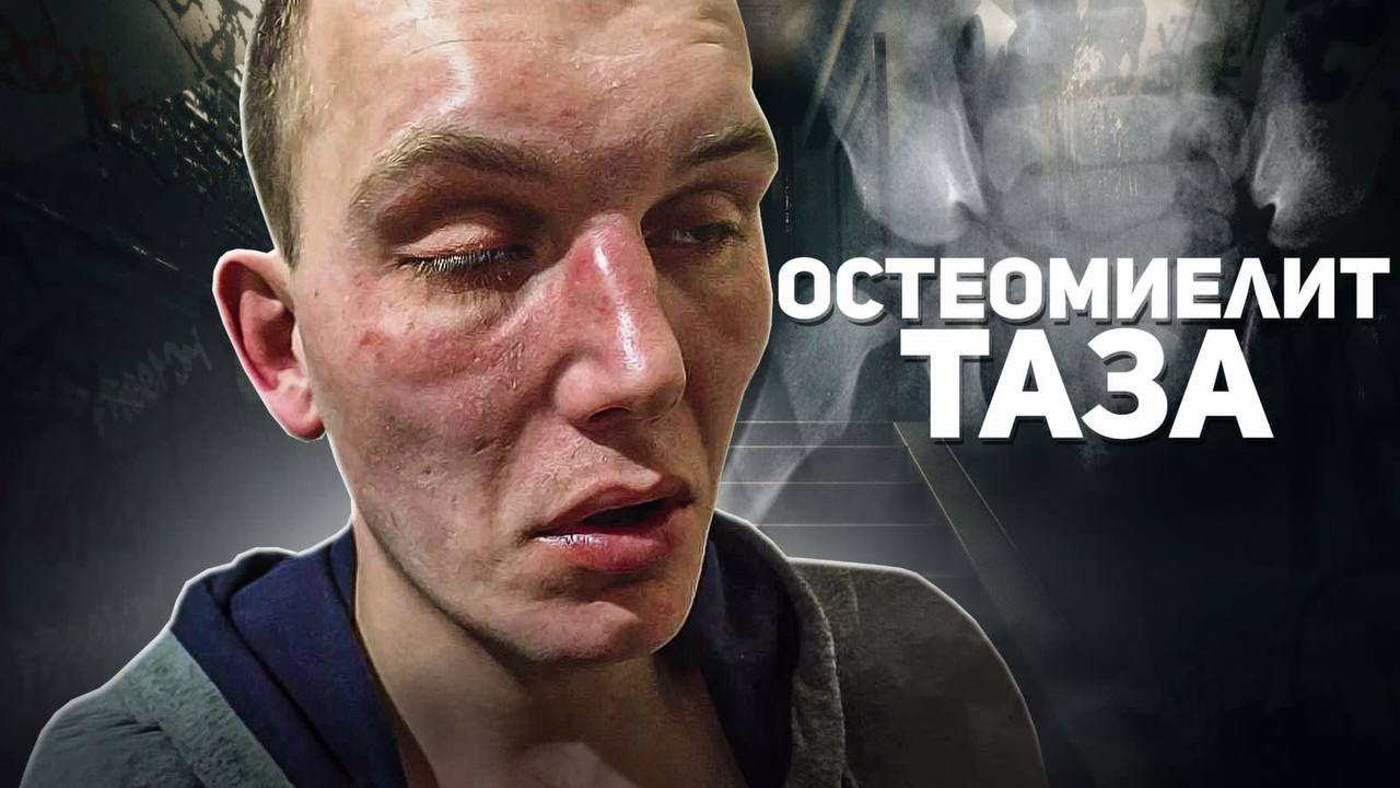 💉ДЕЗОМОРФИН  #наркотики #историиизжизни #последствия