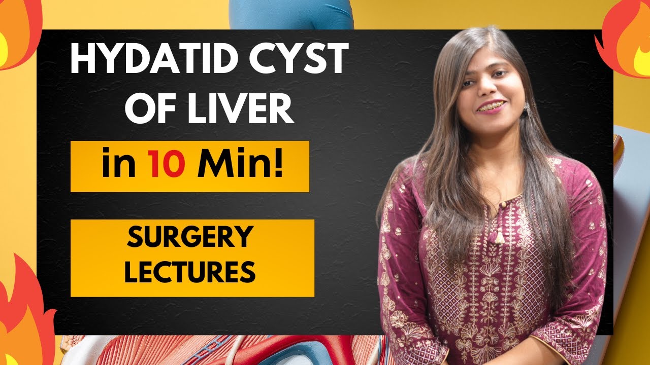 Hydatid cyst of liver - Definition | Clinical Features and Management | Surgery Lecture and Notes