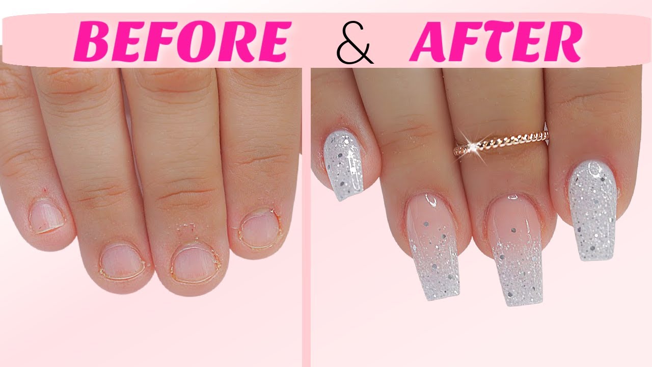 EXTREME Transformation! From BITTEN to GORGEOUS Nails