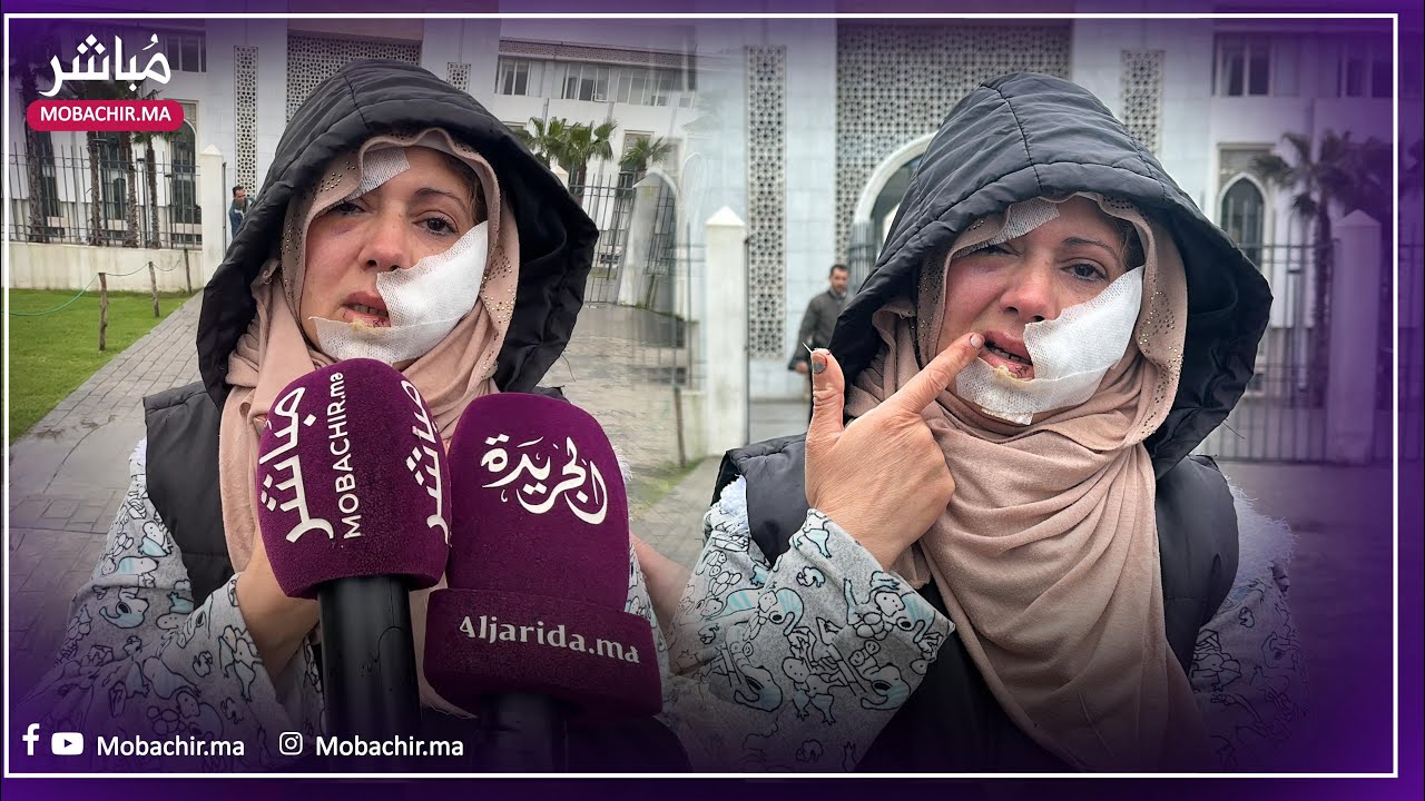 خطـ .ـير..طليق يحاول ذبـ. .ـح زوجته السابقة قرب منزلها بطنجة والضـ .ـحية تنجو بأعجوبة