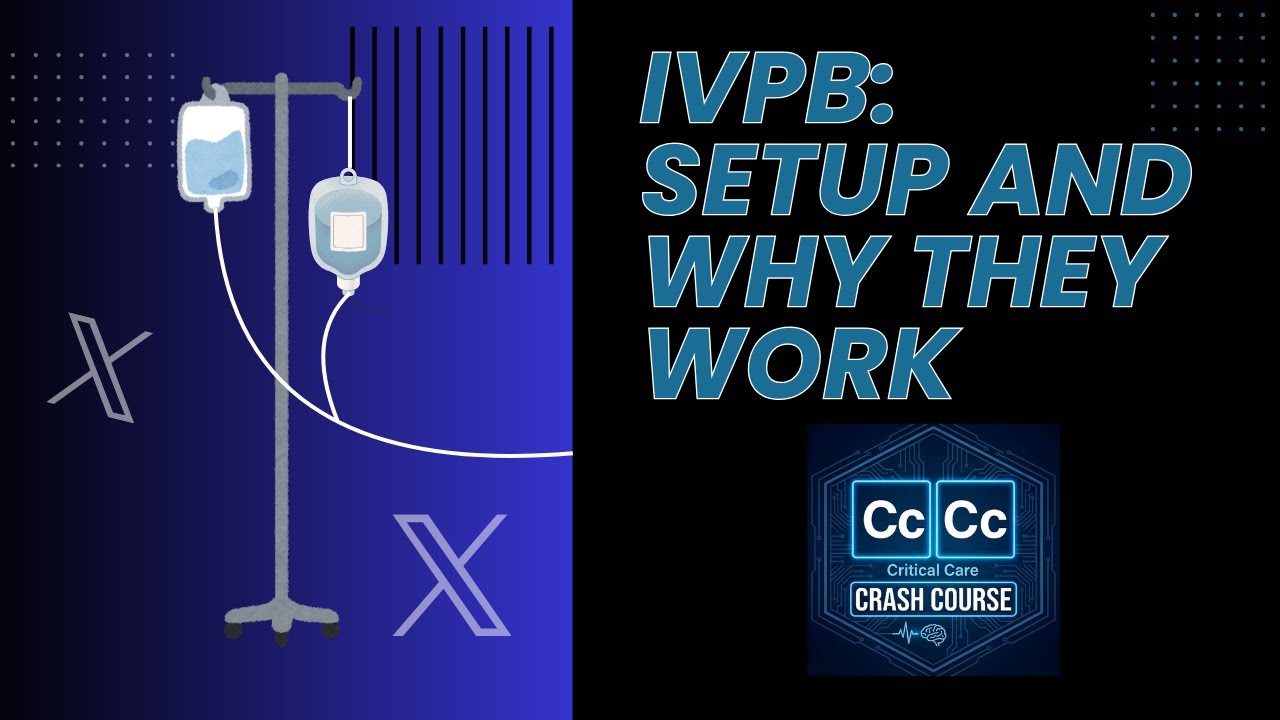 How and why IV secondary's work