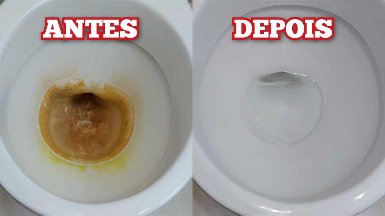Como Tirar Amarelado Encardido Crosta e Marca D'água Do Vaso Sanitário / RECEITA CASEIRA!!