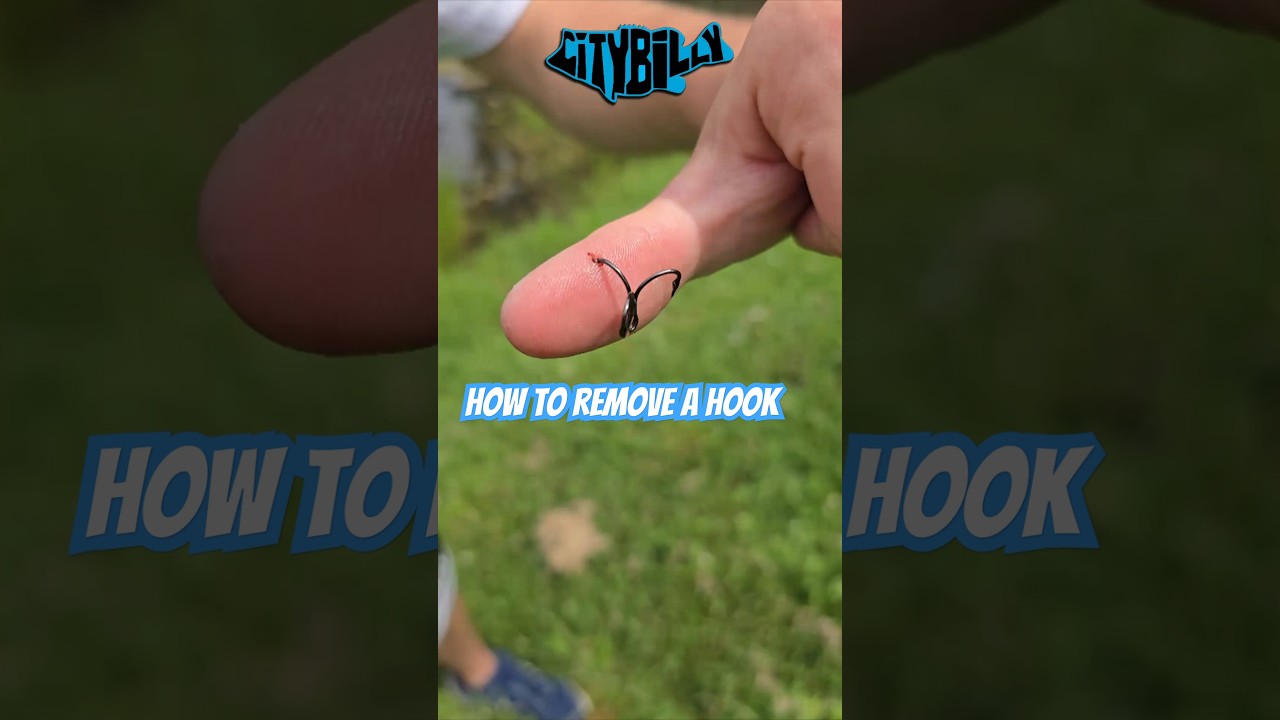 How To Remove A Treble Hook From Your Hand #fishing