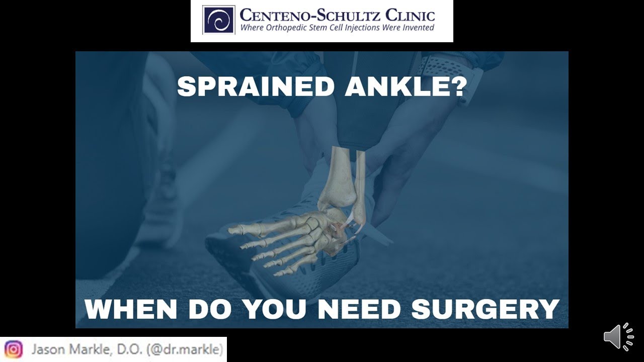 Ankle ligament Tear