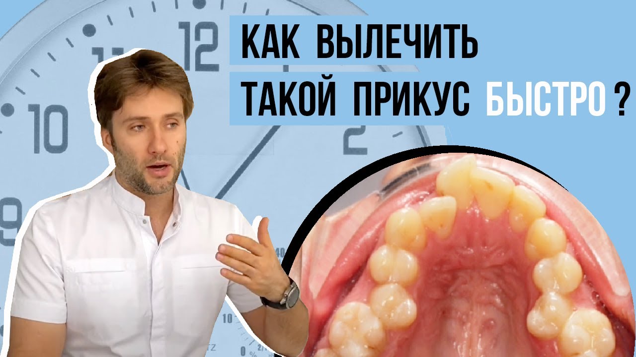 Как многопетлевая дуга ускоряет процесс лечения❓