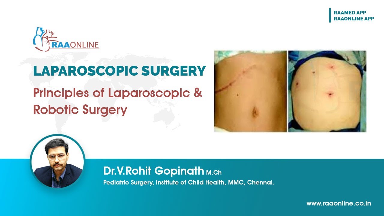 Principles of Laparoscopic and Robotic Surgery