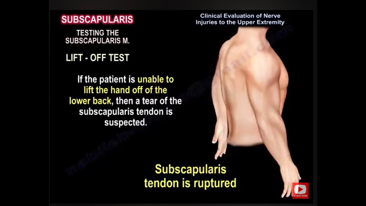 Brachial Plexus, lesions of the brachial plexus. Test your knowledge brachial plexus