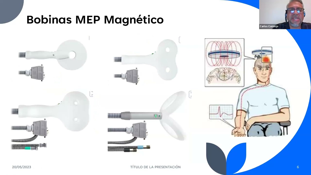 Estimulacion Magnetica Transcraneal