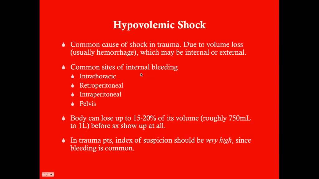 Shock - CRASH! Medical Review Series