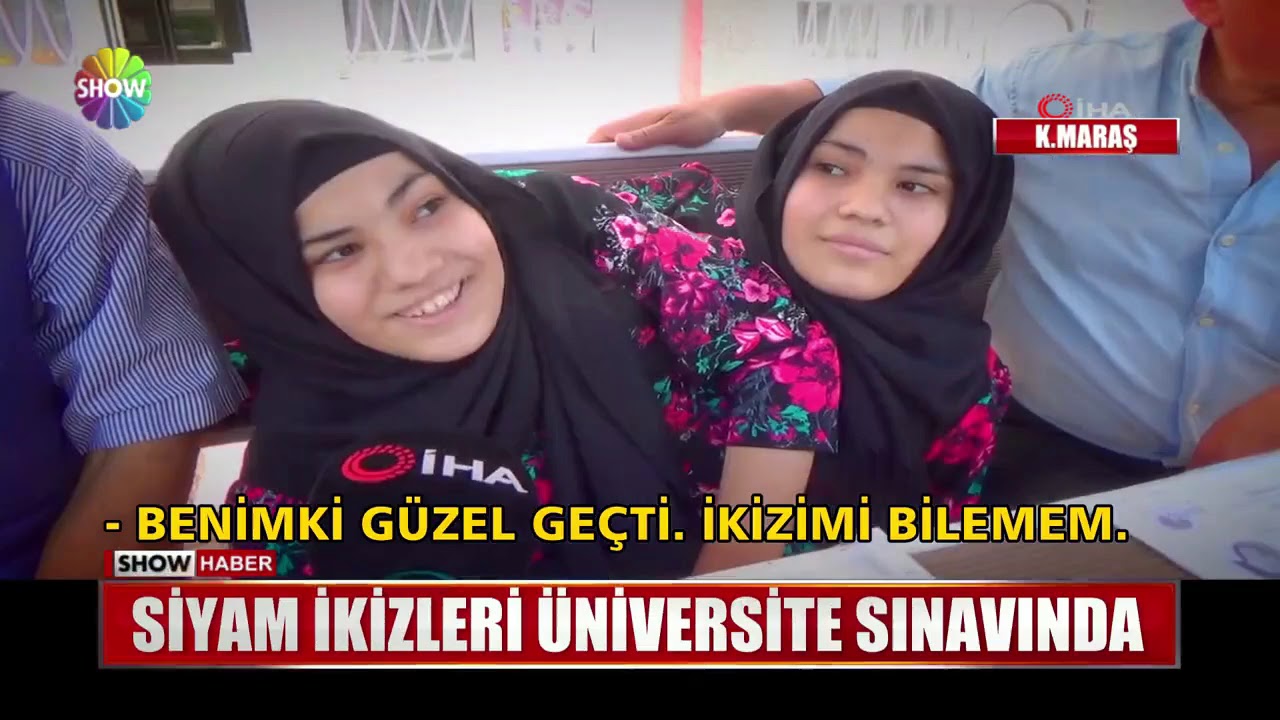 Siyam ikizleri üniversite sınavında