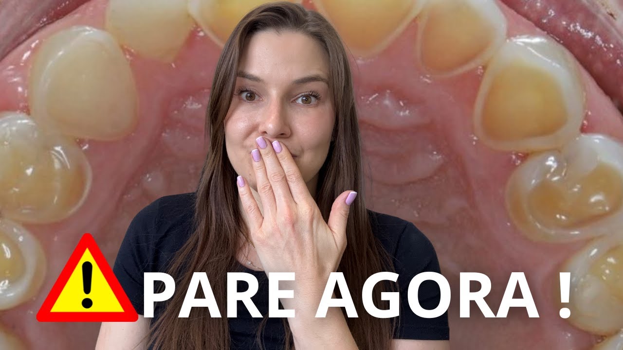 3 ERROS DIÁRIOS que DESGASTAM seus dentes sem você perceber