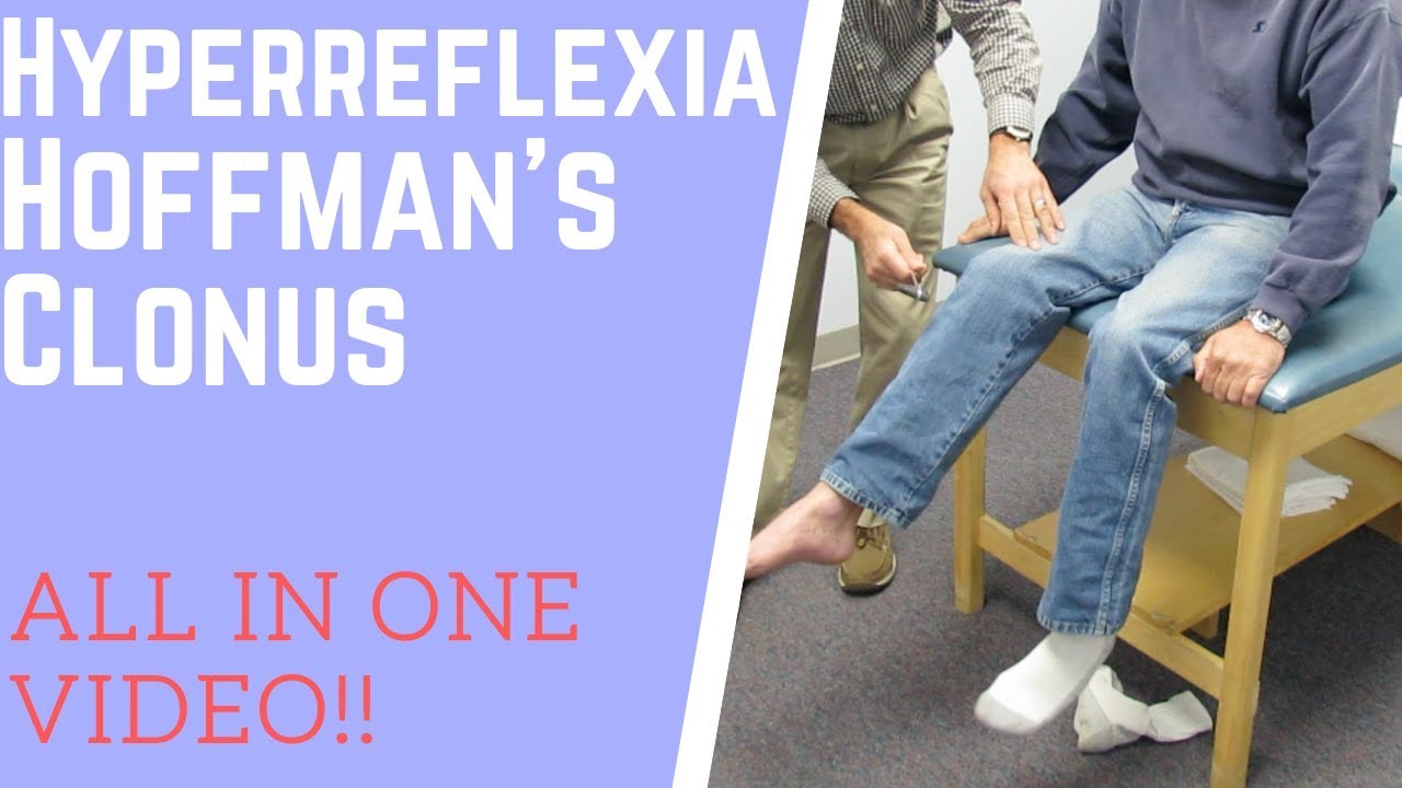Hyperreflexia, clonus and positive Hoffman's sign
