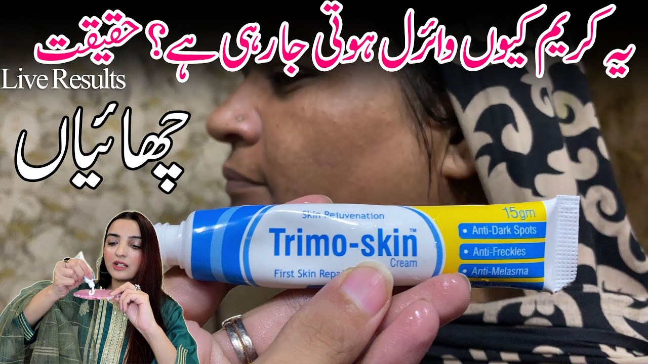 Viral Pigmentation Cream 7 Days Challenge Live Results on my Helper's Face