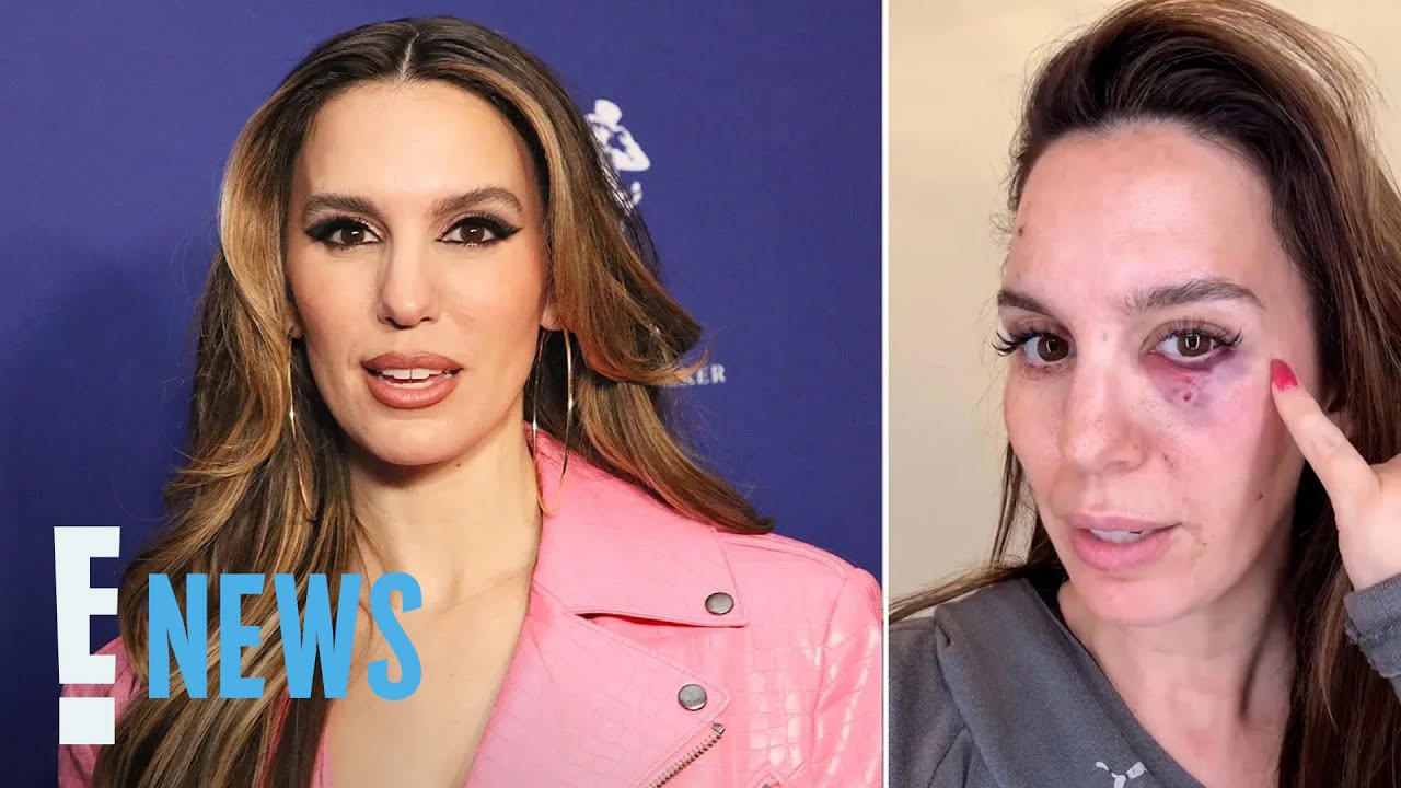 Christy Carlson Romano Hospitalized After Being Shot in the Eye | E! News