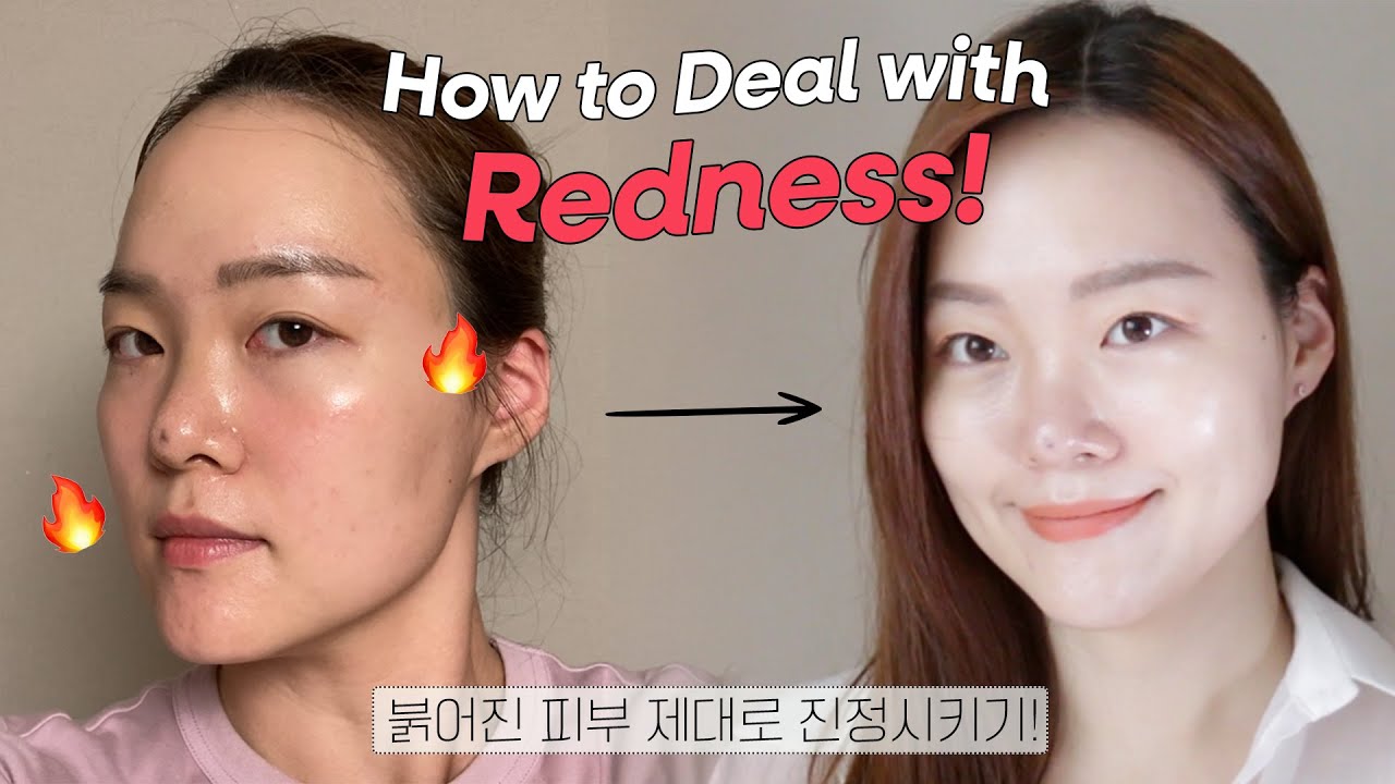 How to PORPERLY deal with redness🔥