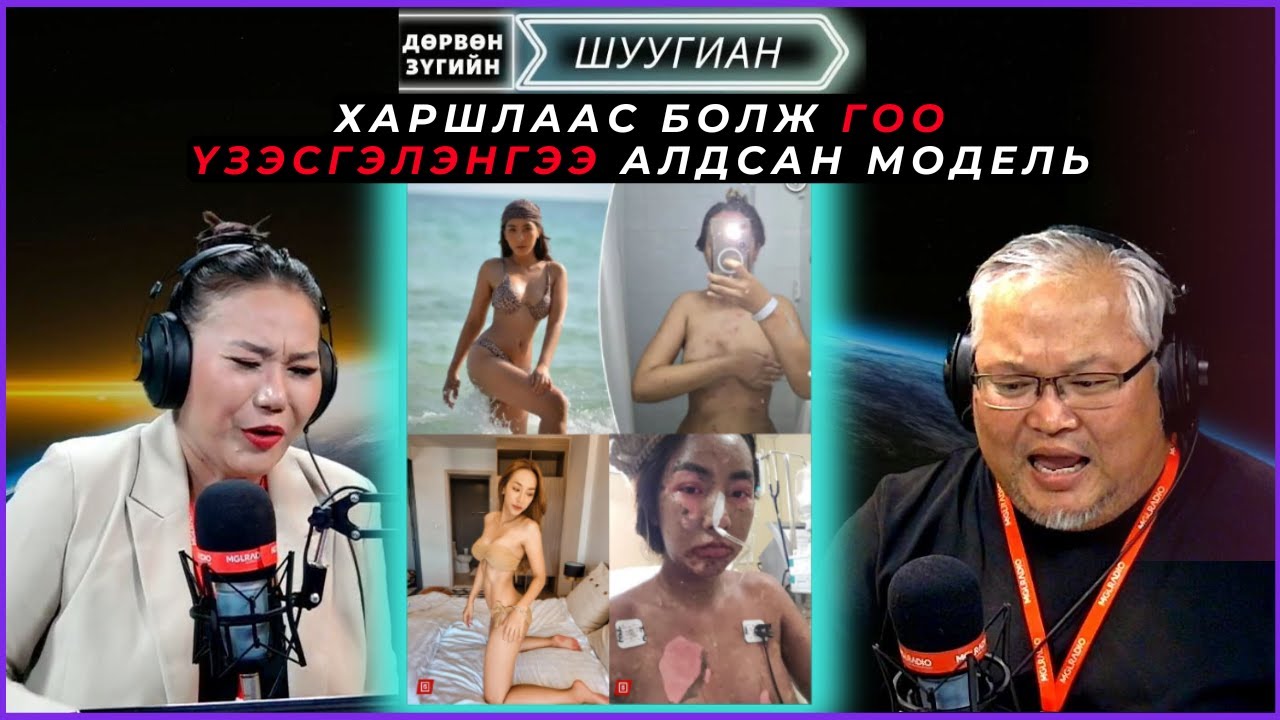Дөрвөн зүгийн шуугиан | 2024-09-18 | Харшлаас болж гоо үзэсгэлэнгээ алдсан модель