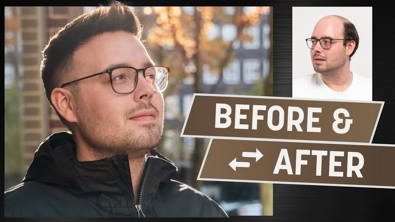 Hairsystem upgrade: from hey2go to custom-made | Levelling up your hair situation!
