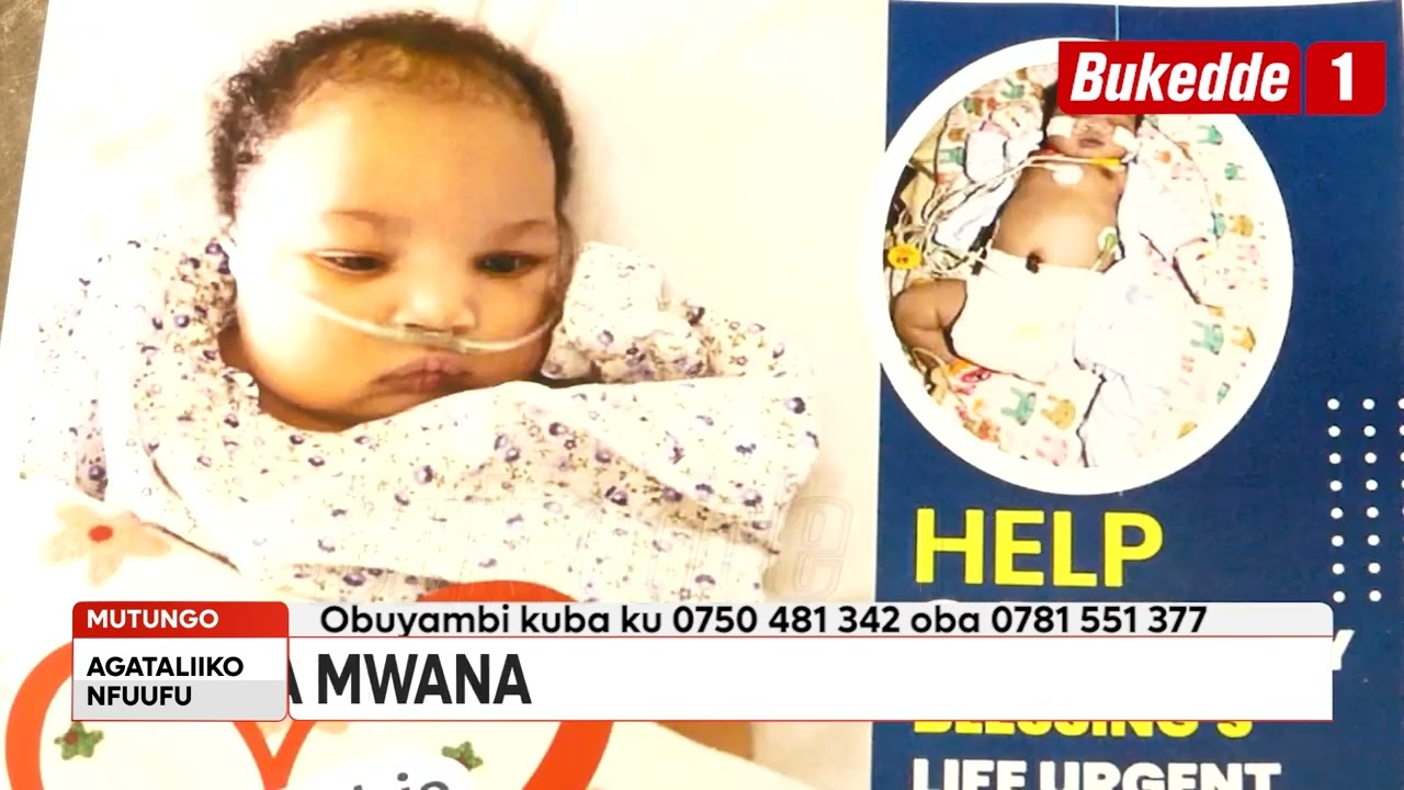 Agataliikonfuufu   Wuuno Maama alina omwana aliko obuzibu ku misiwa egitambuza omusaayi  Alajaanye a