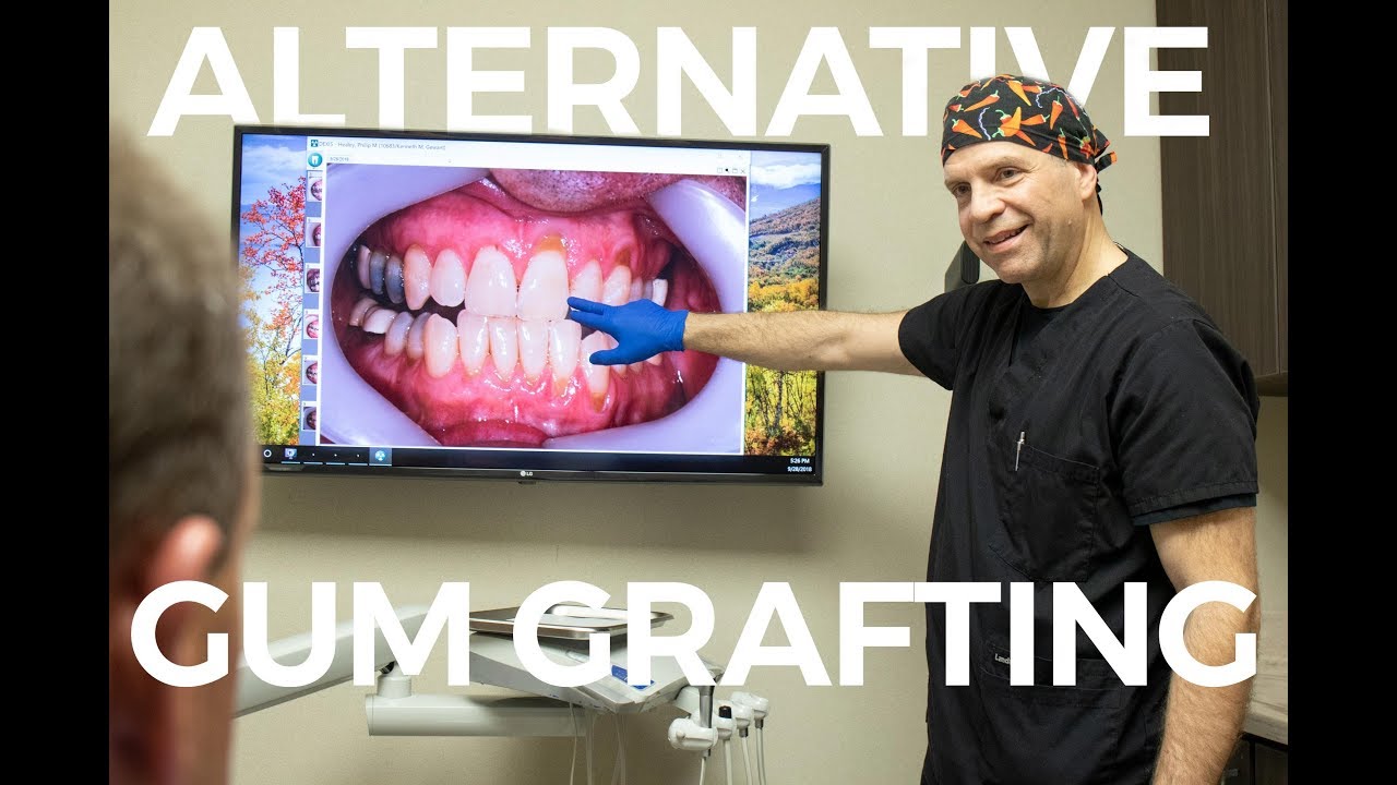 Dr. Gewant Discusses the Advantages of Alloderm Gum Graft