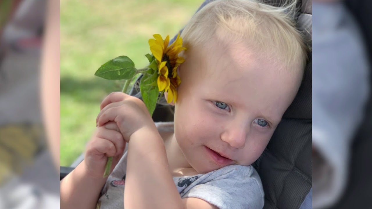 Pierre Robin Sequence and Cleft Palate, The Children's Hospital of Buffalo Foundation