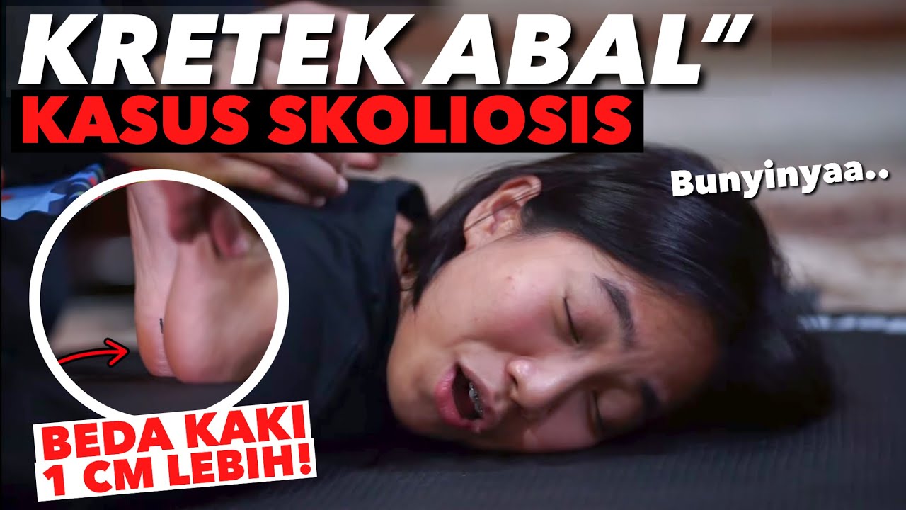 KRETEK2 GADIS SKOLIOSIS.. NONTON PAKAI HEADSET!