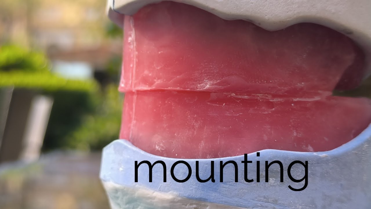 عمل طقم الاسنان الكامل | part 3               mounting. طب الاسنان المرحله الثانيه بروس ✅💯🔥.