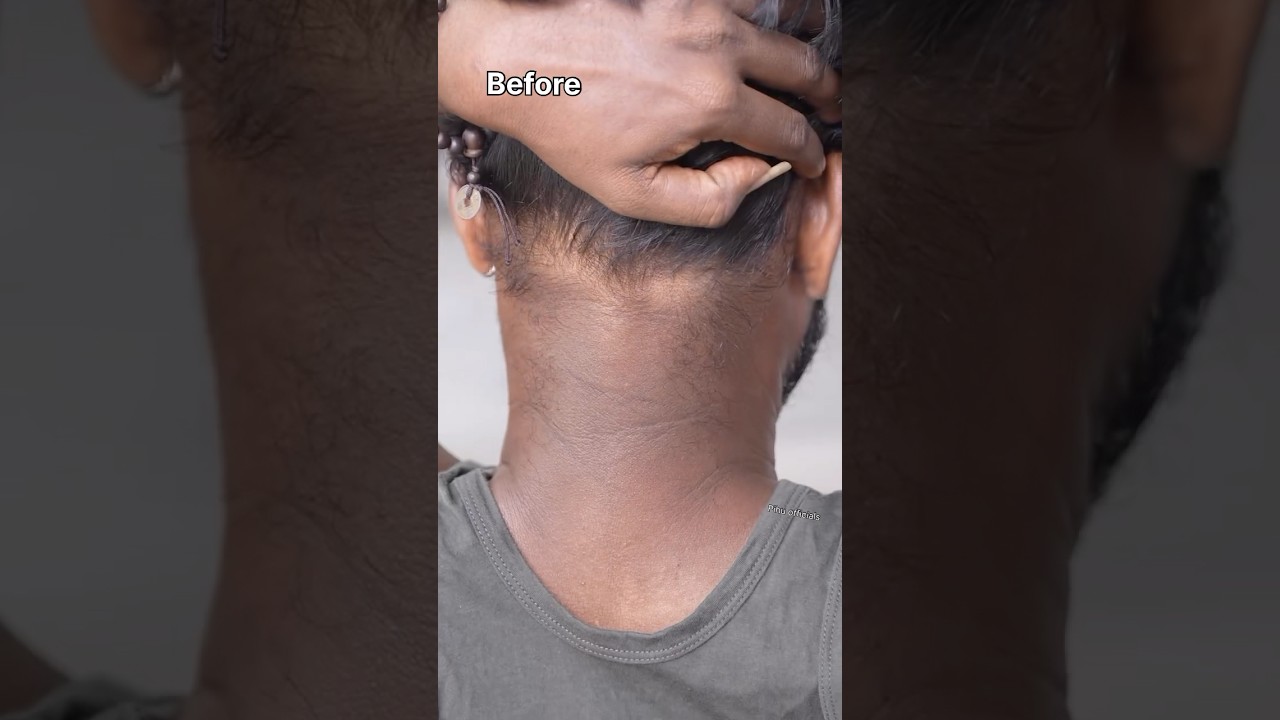 Remove Neck Darkness At Home In 5min | Neck Cleaning Tips | Dark Neck Remove Home Remedies #shorts