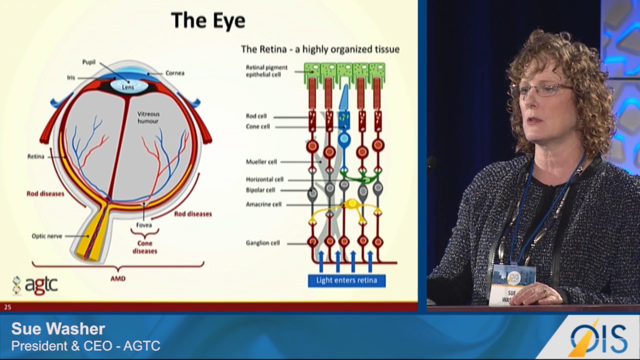AGTC XLRS Platform Well Tolerated (OIS@AAO 2016)