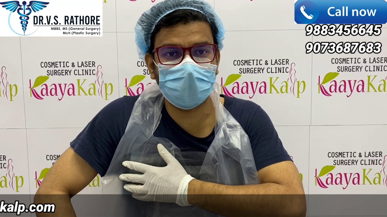 Gynecomastia Surgery Experience | Patient Review | Dr. V. S. Rathore | Kaayakalp | Hindi