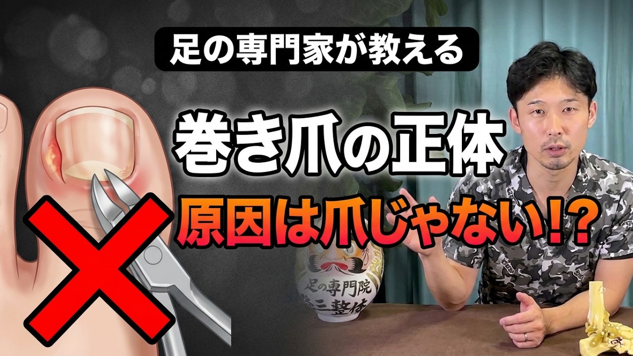 【衝撃】９割の人が間違ってる！巻き爪の本当の原因、実は○○だった！知らないと一生治らない理由