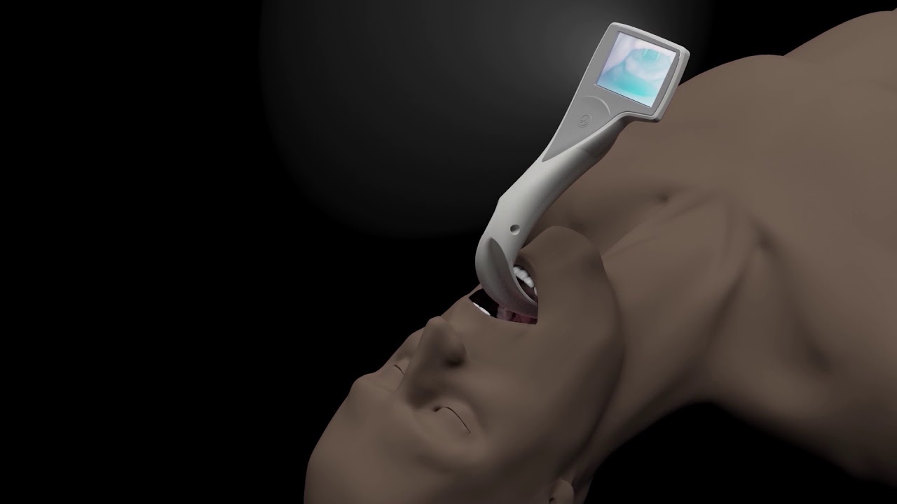 Videolaringoscopio i-view™. Completamente desechable