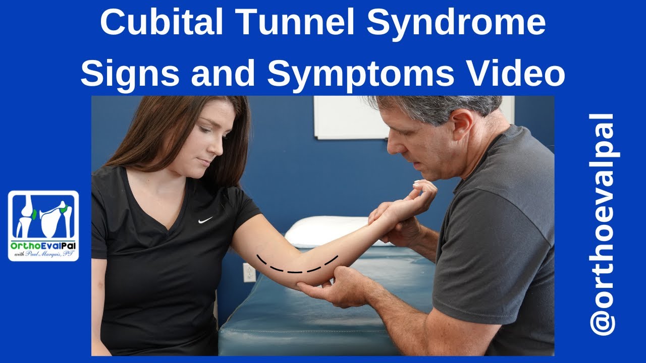 Cubital Tunnel Syndrome: Signs and Symptoms