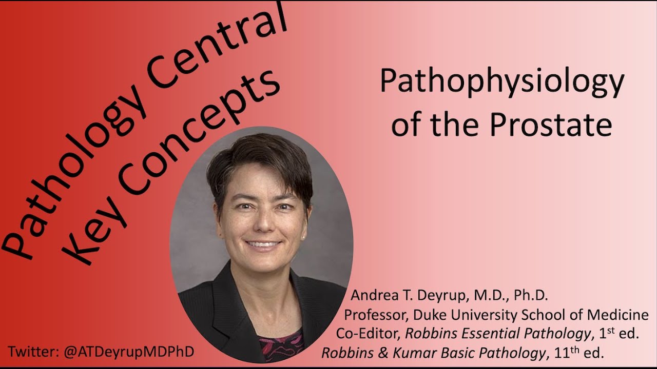 Medical School Pathology: Pathophysiology of the Prostate