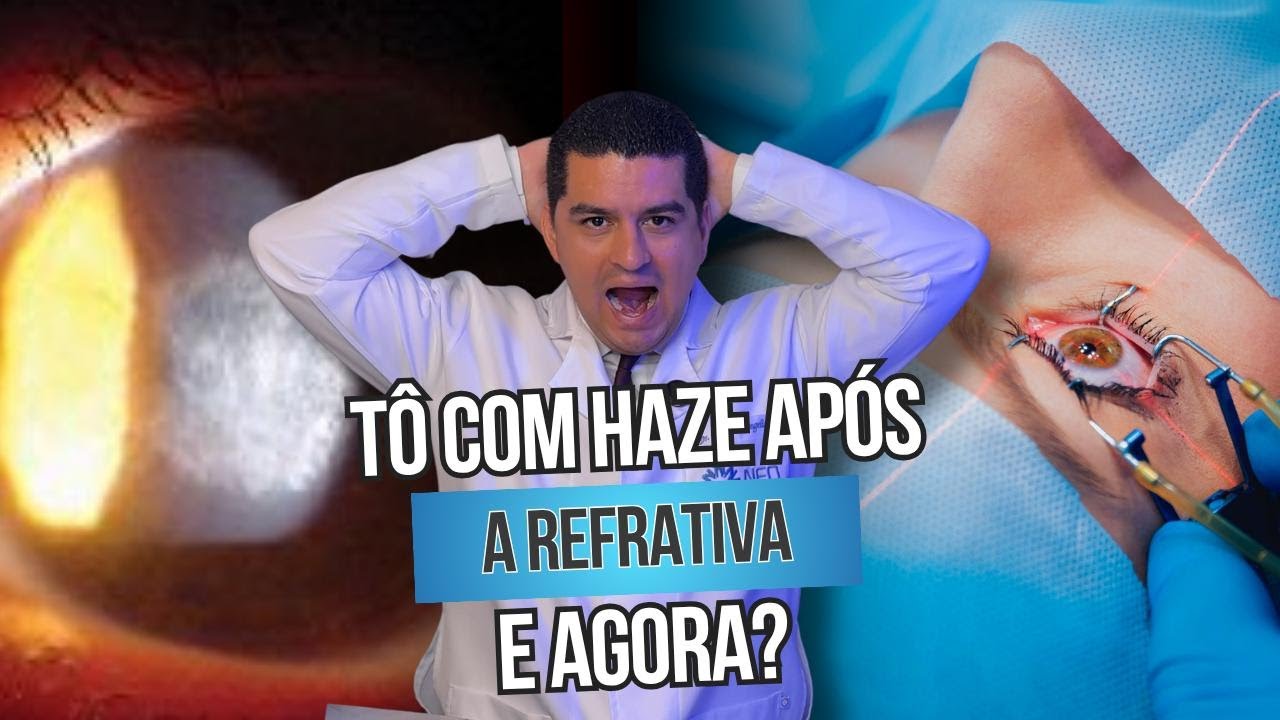 Tô com haze após a refrativa, e agora?