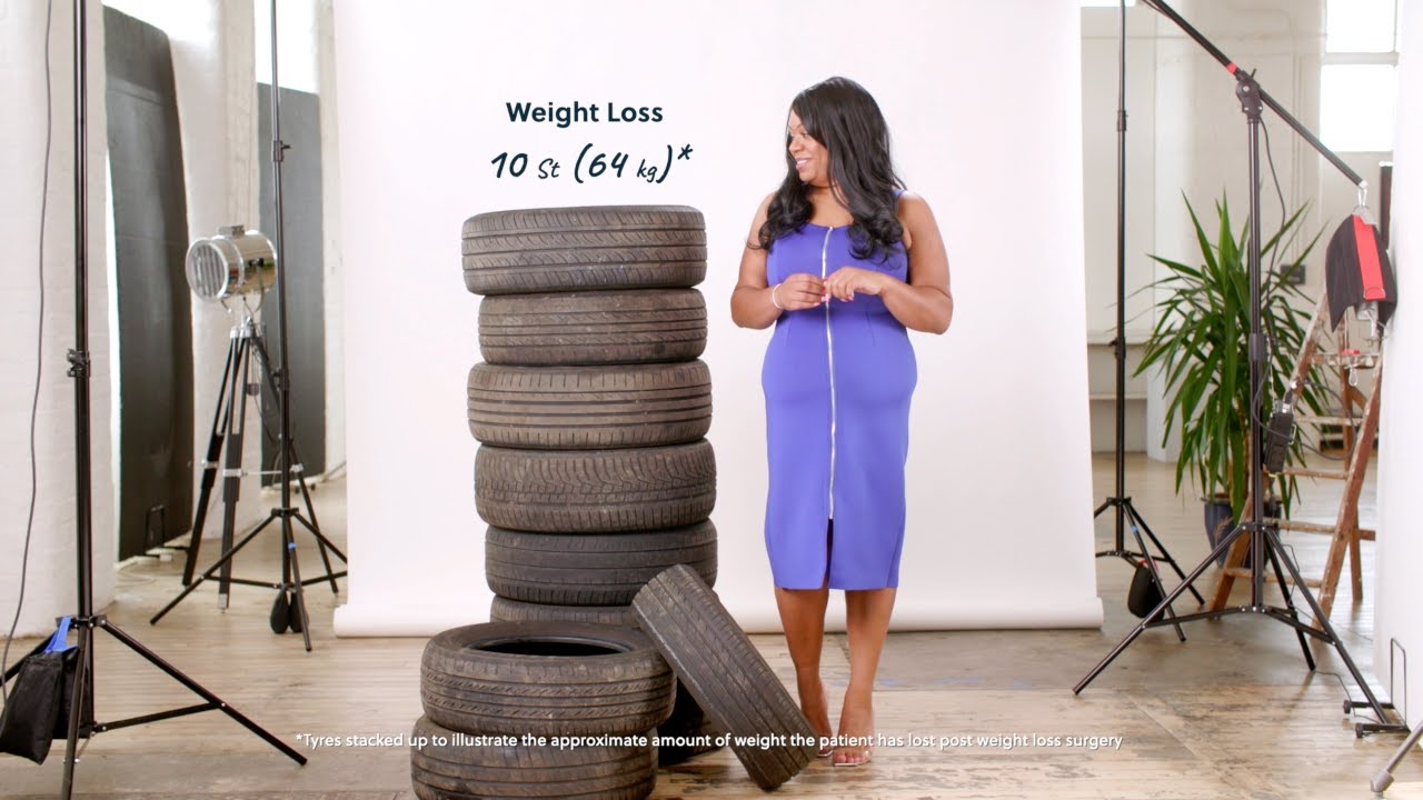 10 stone loss after Gastric Sleeve Surgery - Ally's Weight Loss Story
