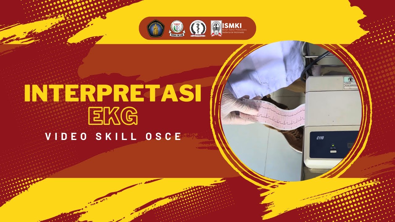[VIDEO SKILL OSCE - INTERPRETASI EKG]