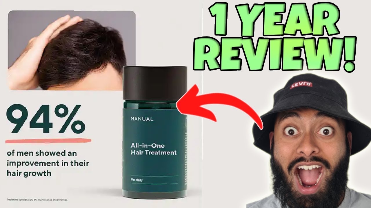 MANUAL 1 Year Hair Treatmemt Results With Finasteride & Minoxidil!
