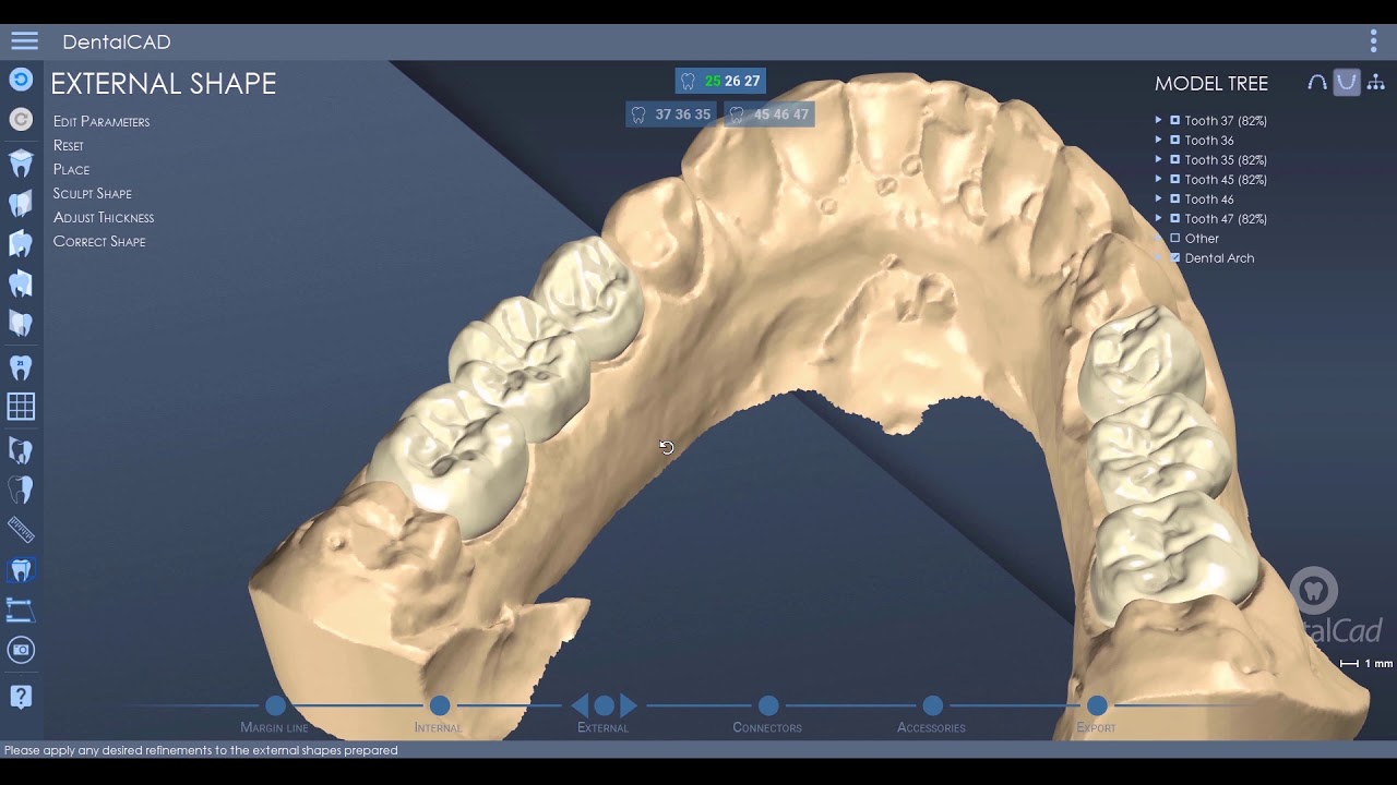 DentalCad 2020 - Novedades pt. 1