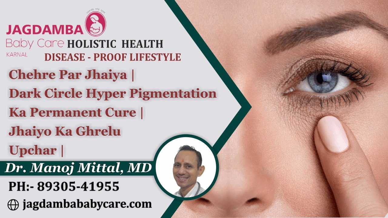 chehre par jhaiya | Dark Circle Hyper Pigmentation ka Permanent Cure | jhaiyo ka ghrelu upchar |