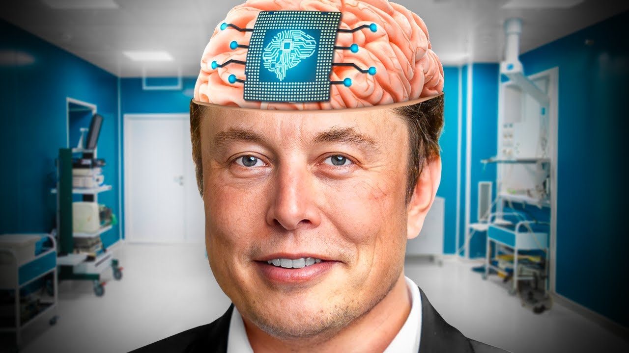 Elon Musk veut implanter une puce dans votre cerveau