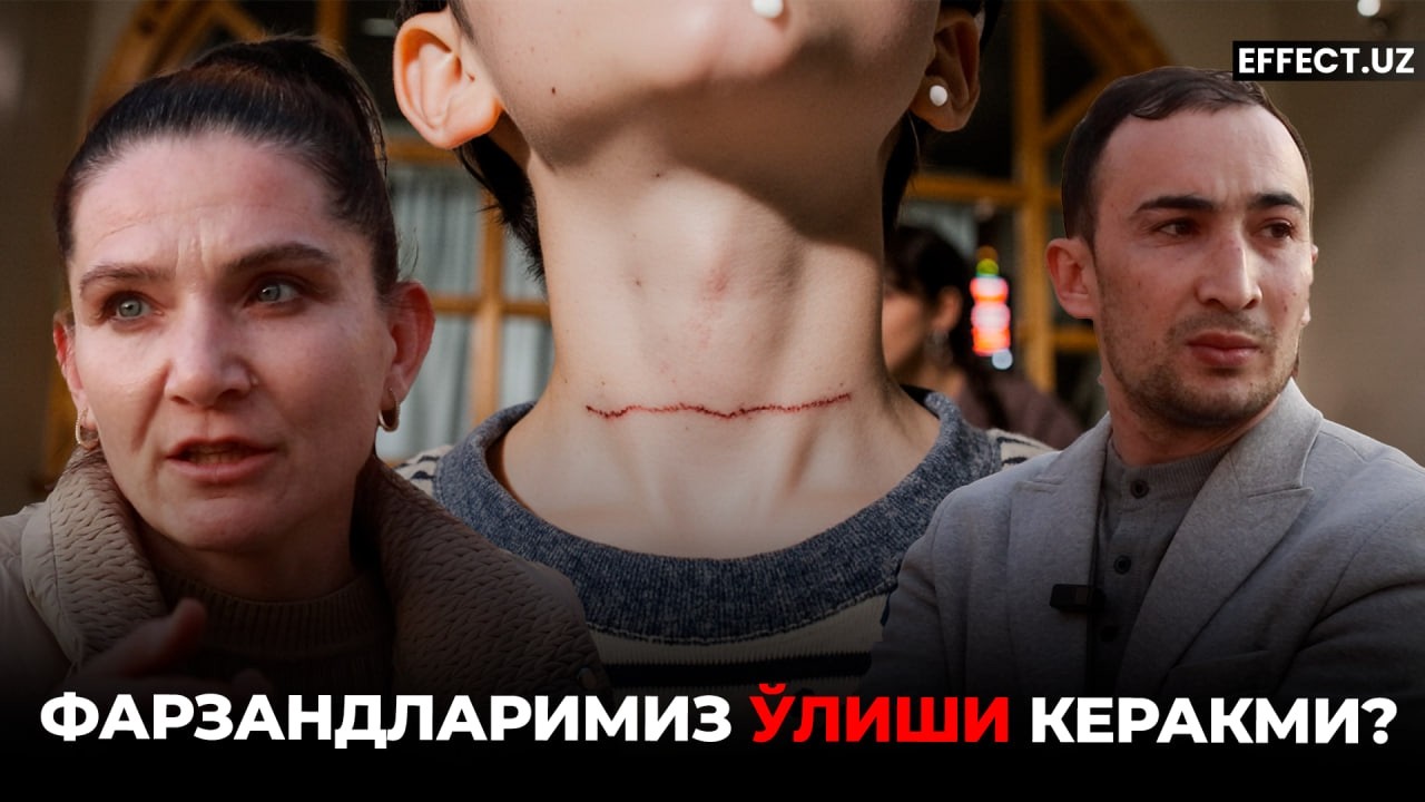 БОҒЧА БОЛАЛАРИНИНГ 