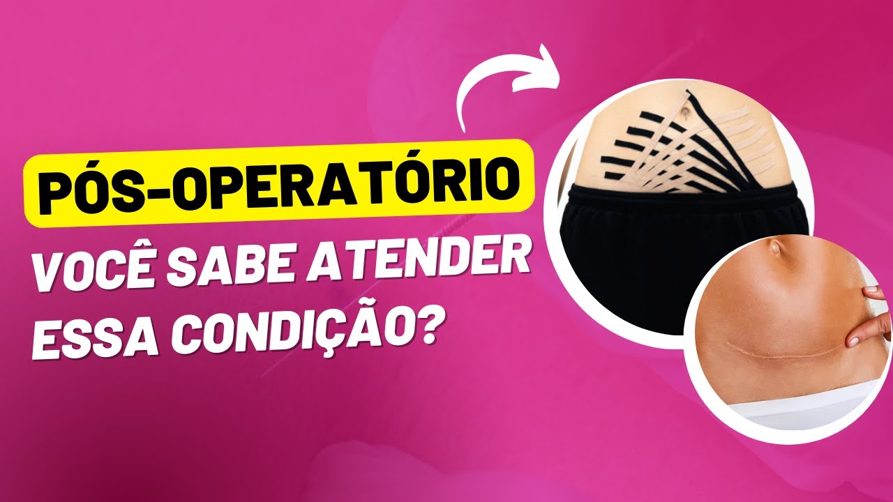 PÓS OPERATÓRIO NA ESTÉTICA: Você sabe atender essa condição?