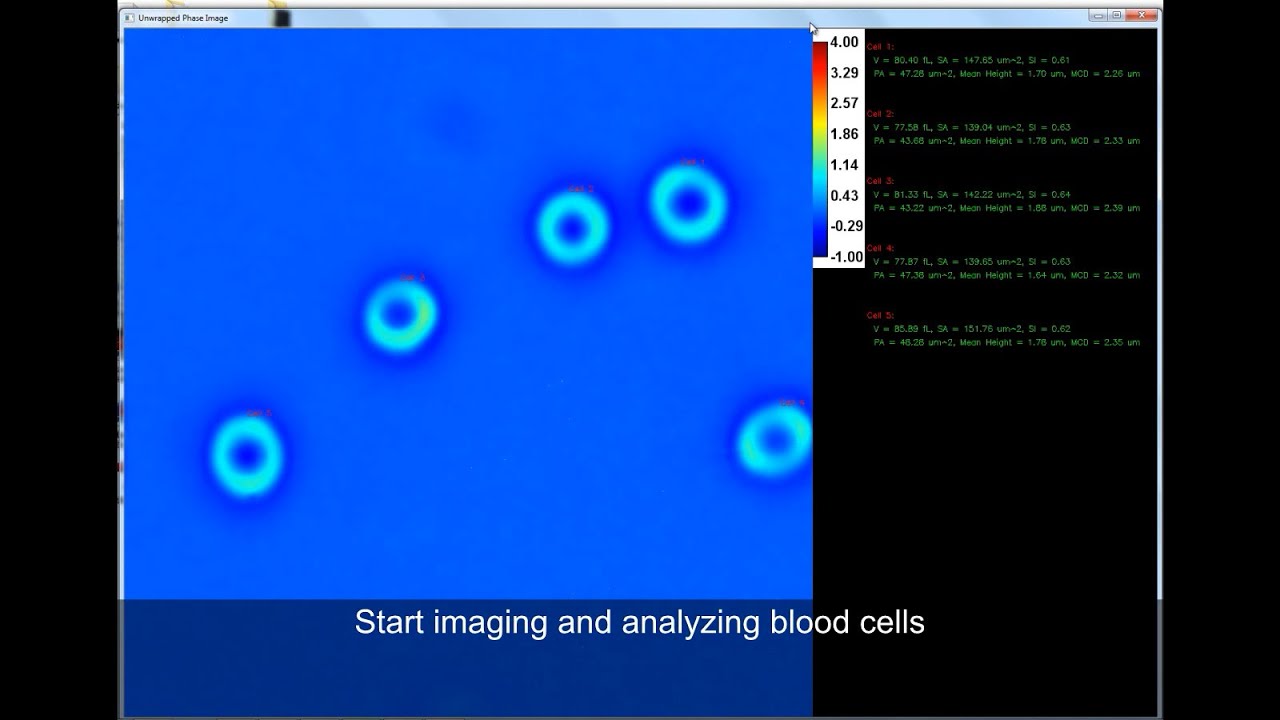 Real-time blood testing using Quantitative Phase Imaging