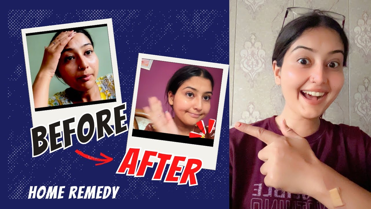 Kya sach me meri Tanning chli gyi😱#viralvideo #sakshivlogs #sakshikala 