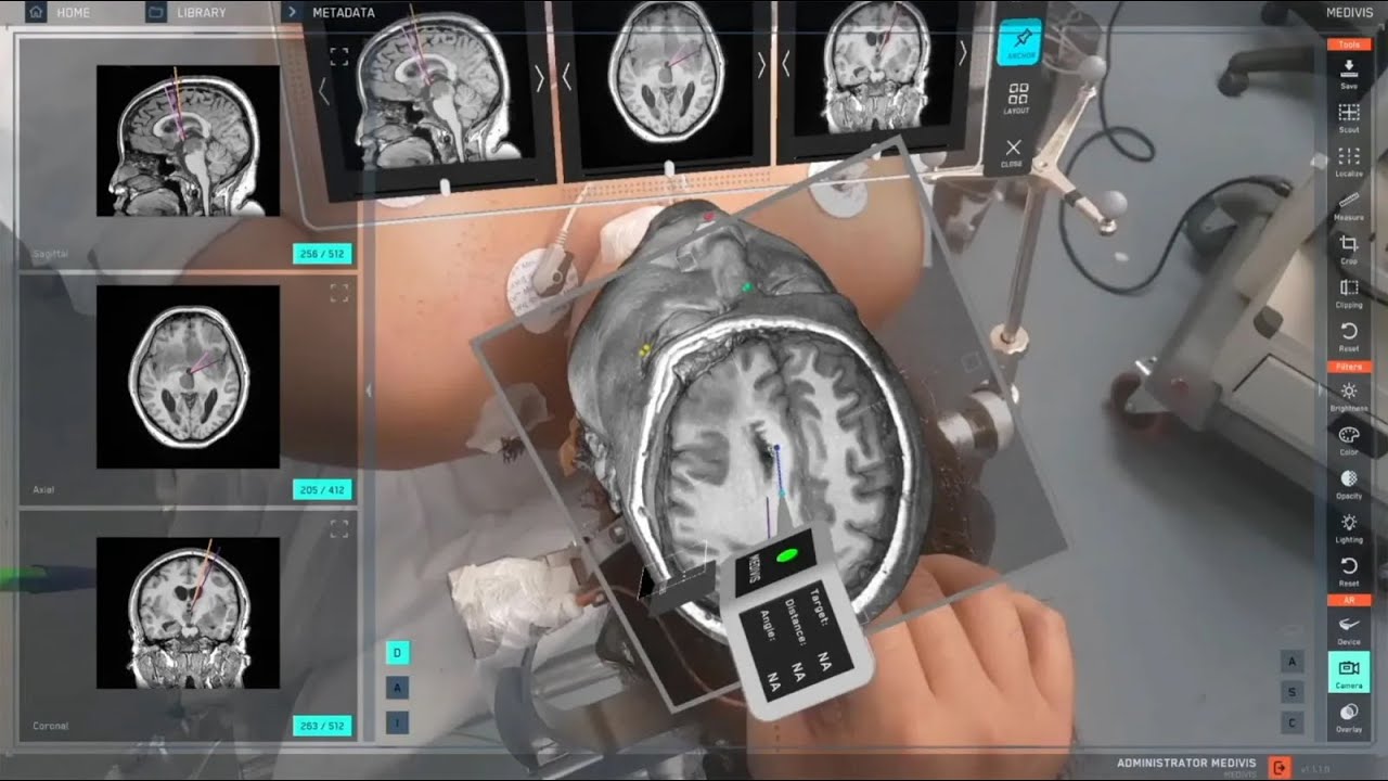 Doctor&rsquo;s Aid Medivis SurgicalAR | AnatomyX 3D learning platform for medical education