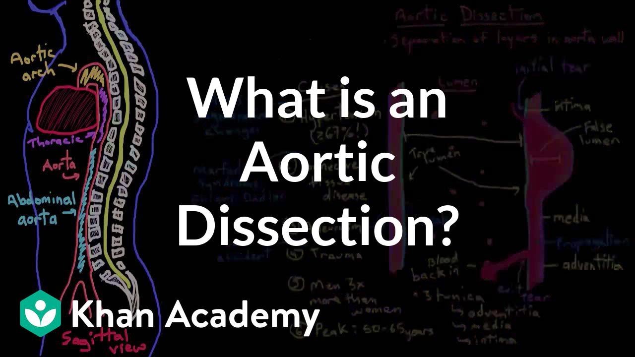 What is an aortic dissection? | Circulatory System and Disease | NCLEX-RN | Khan Academy