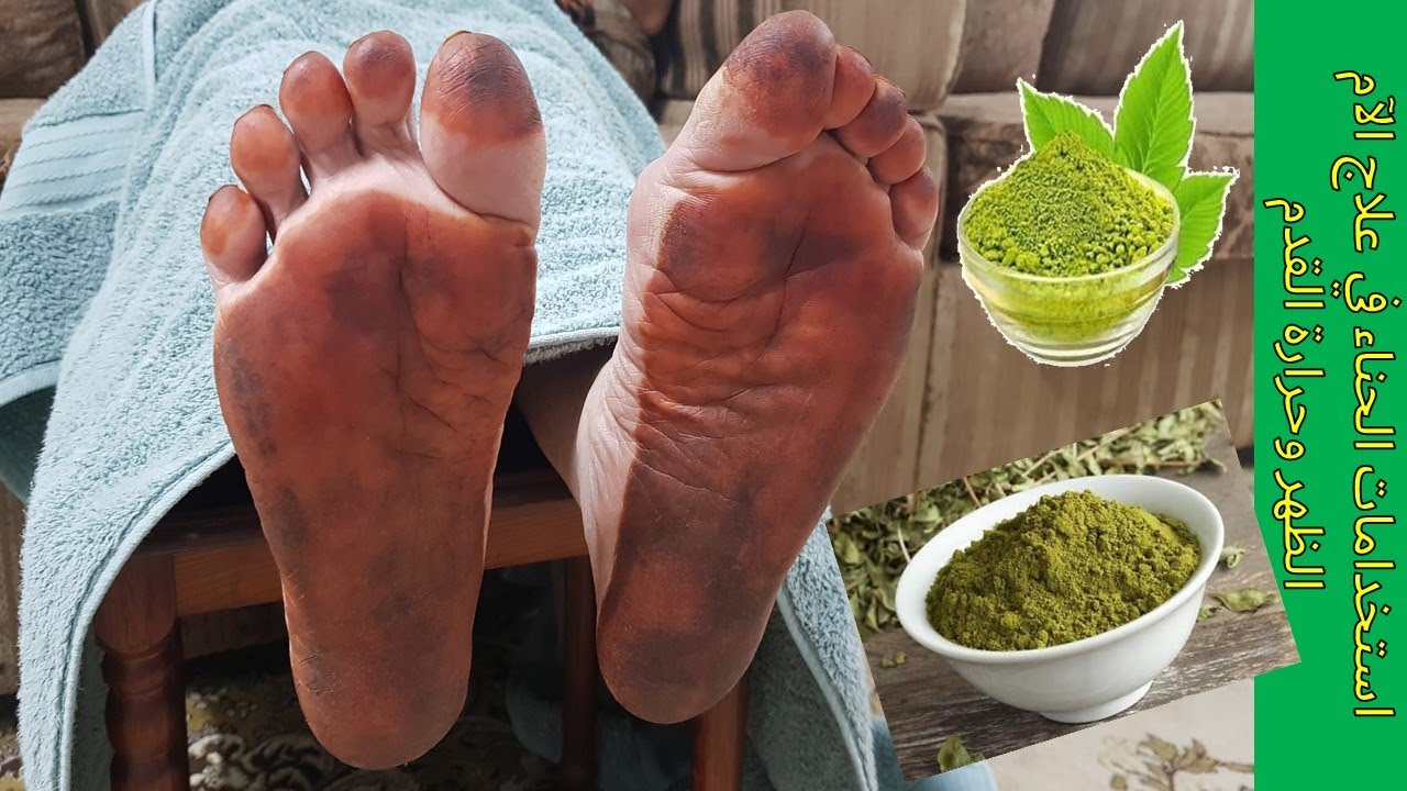 استخدامات الحناء في علاج الآم الظهر وحرارة القدمUses of henna in the treatment of back And the foot.