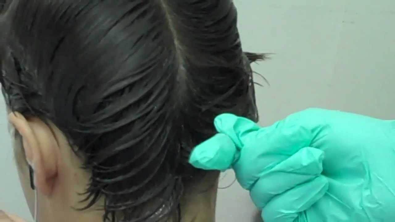 What do lice eggs (nits) look like?